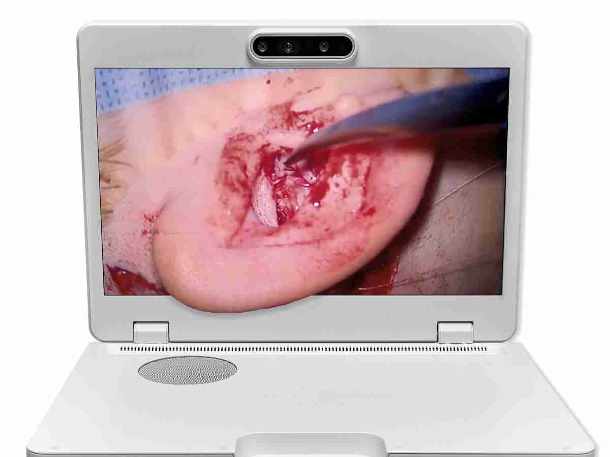 达擎之＂Heads-up 3D显微手术显示系统＂，，，，整合4K裸眼3D显示及眼球追踪系统，，具备快速追踪人眼移动位置功能，，减轻医师长时间维持固定姿势的负担，，，，让医师能有更宽广清晰的3D立体视野及更舒适的姿势来执行手术。。。。